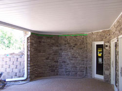 under decking systems